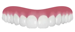 dental veneers