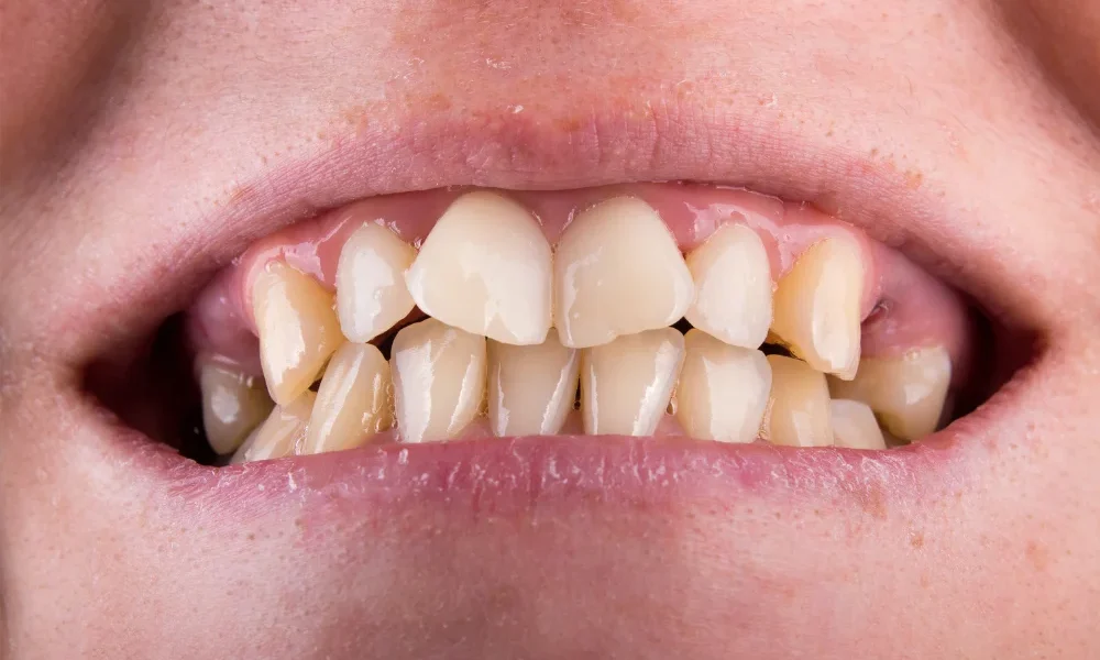 Before Dental Treatment